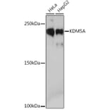 Western Blot - Anti-KDM5A/Jarid1A/RBBP2 Antibody [ARC1120] (A306168) - Antibodies.com