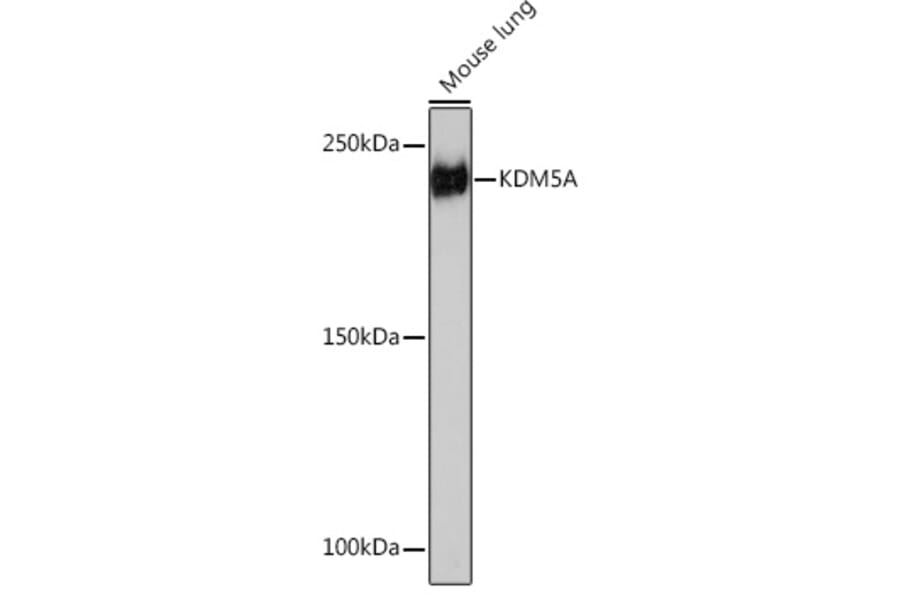 Western Blot - Anti-KDM5A/Jarid1A/RBBP2 Antibody [ARC1120] (A306168) - Antibodies.com
