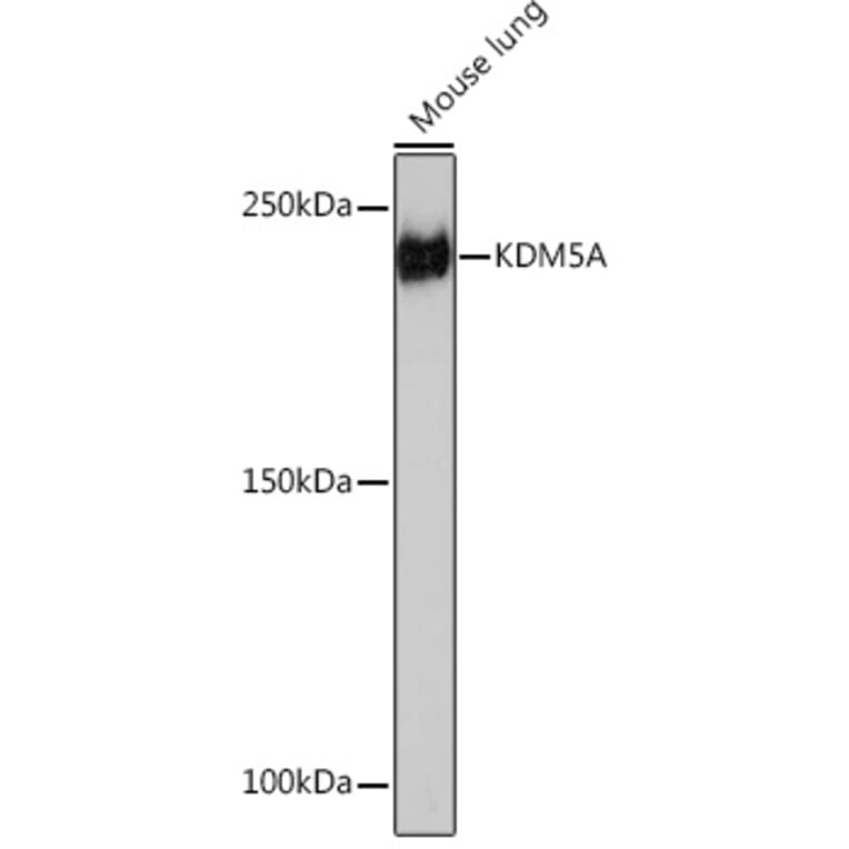 Western Blot - Anti-KDM5A/Jarid1A/RBBP2 Antibody [ARC1120] (A306168) - Antibodies.com