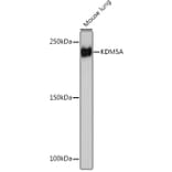 Western Blot - Anti-KDM5A/Jarid1A/RBBP2 Antibody [ARC1120] (A306168) - Antibodies.com
