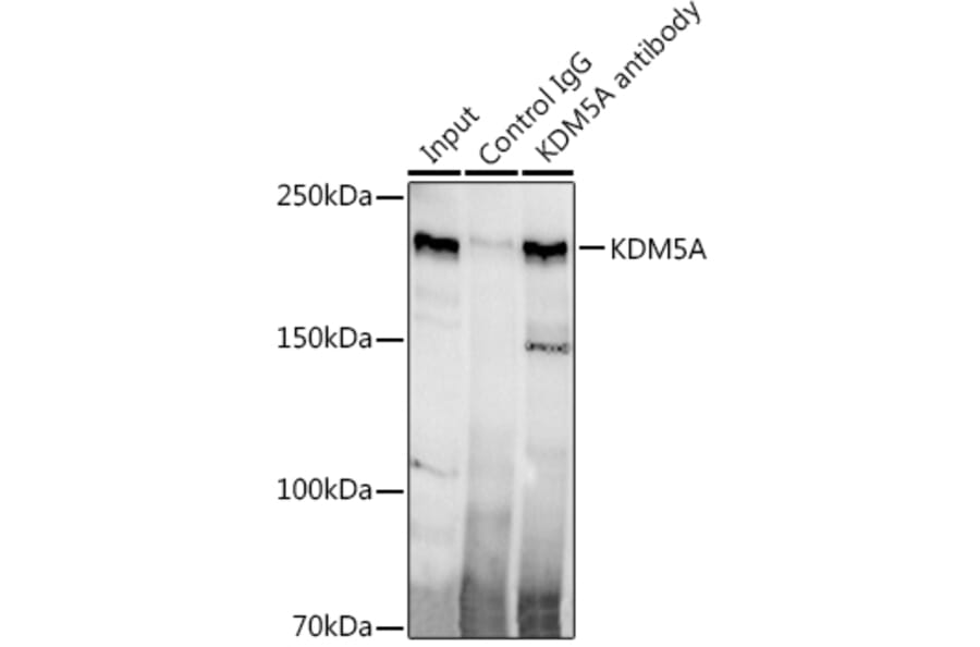 Western Blot - Anti-KDM5A/Jarid1A/RBBP2 Antibody [ARC1120] (A306168) - Antibodies.com