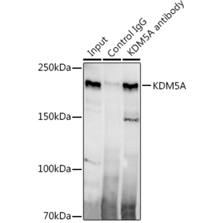 Western Blot - Anti-KDM5A/Jarid1A/RBBP2 Antibody [ARC1120] (A306168) - Antibodies.com