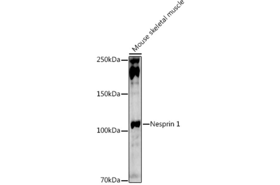 Western Blot - Anti-Nesprin1/Syne-1 Antibody (A306171) - Antibodies.com