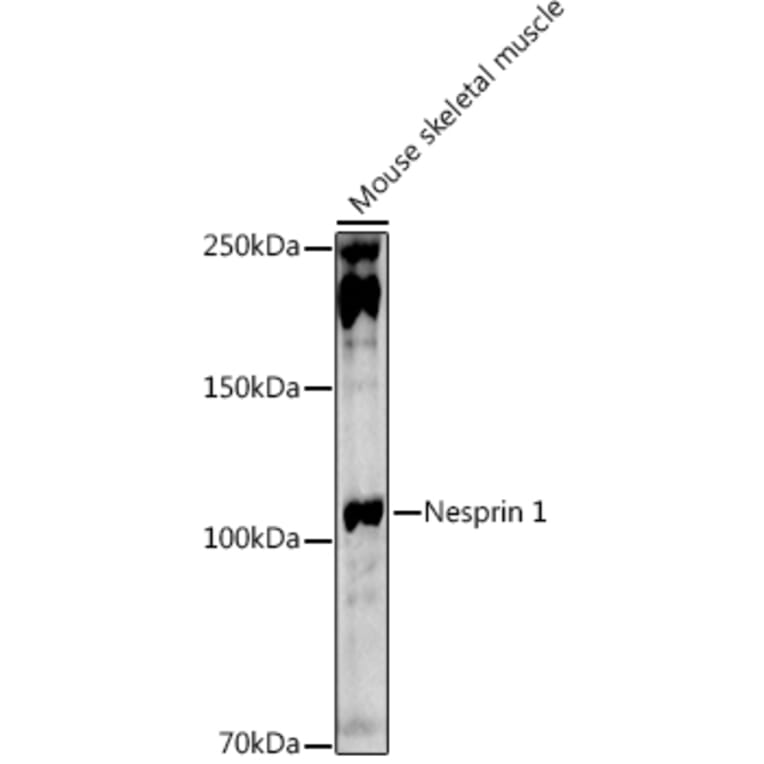 Western Blot - Anti-Nesprin1/Syne-1 Antibody (A306171) - Antibodies.com