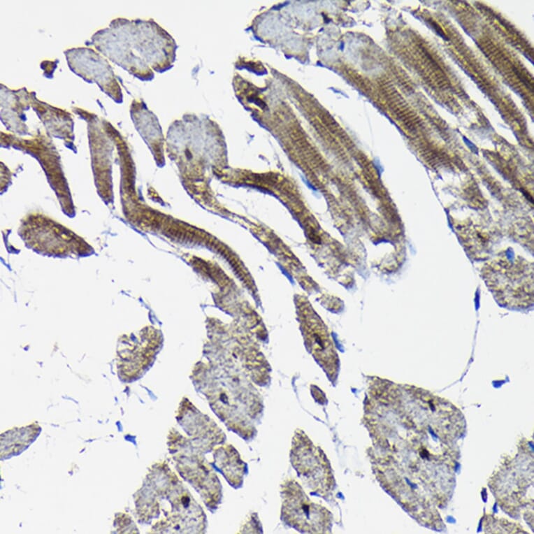 Immunohistochemistry - Anti-Nesprin1/Syne-1 Antibody (A306171) - Antibodies.com