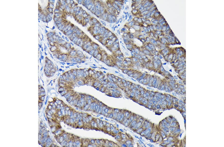 Immunohistochemistry - Anti-Nesprin1/Syne-1 Antibody (A306171) - Antibodies.com
