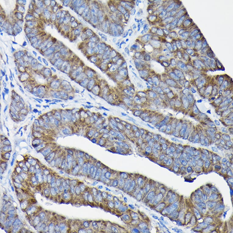 Immunohistochemistry - Anti-Nesprin1/Syne-1 Antibody (A306171) - Antibodies.com