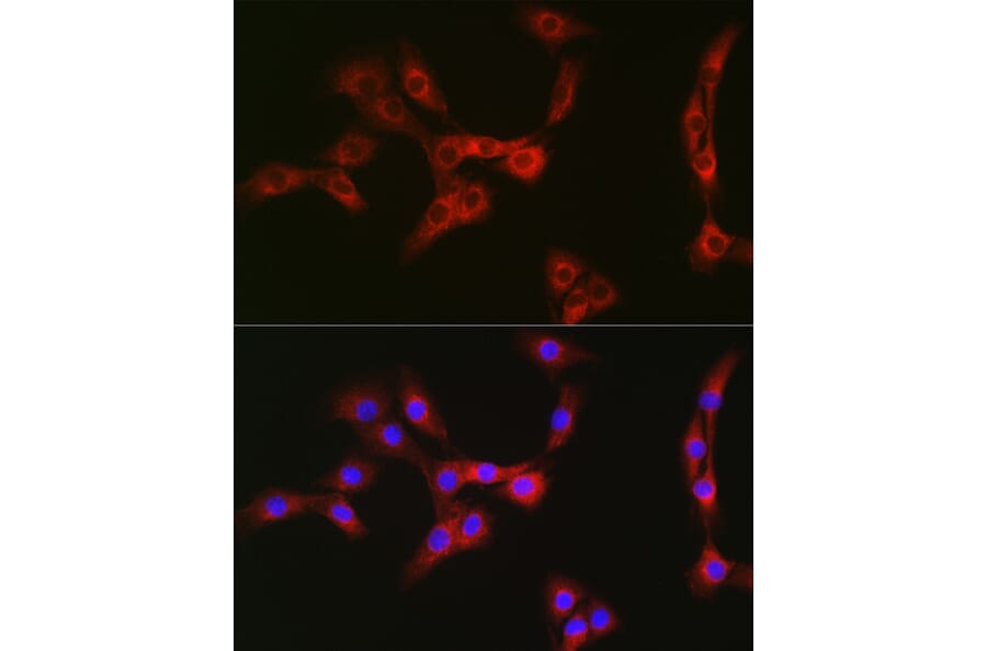 Immunofluorescence - Anti-Nesprin1/Syne-1 Antibody (A306171) - Antibodies.com