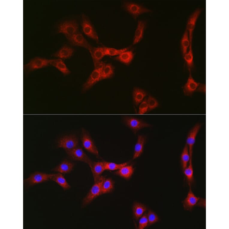 Immunofluorescence - Anti-Nesprin1/Syne-1 Antibody (A306171) - Antibodies.com