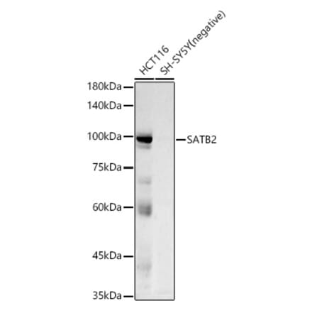 Western Blot - Anti-SATB2 Antibody [ARC50977] (A306174) - Antibodies.com