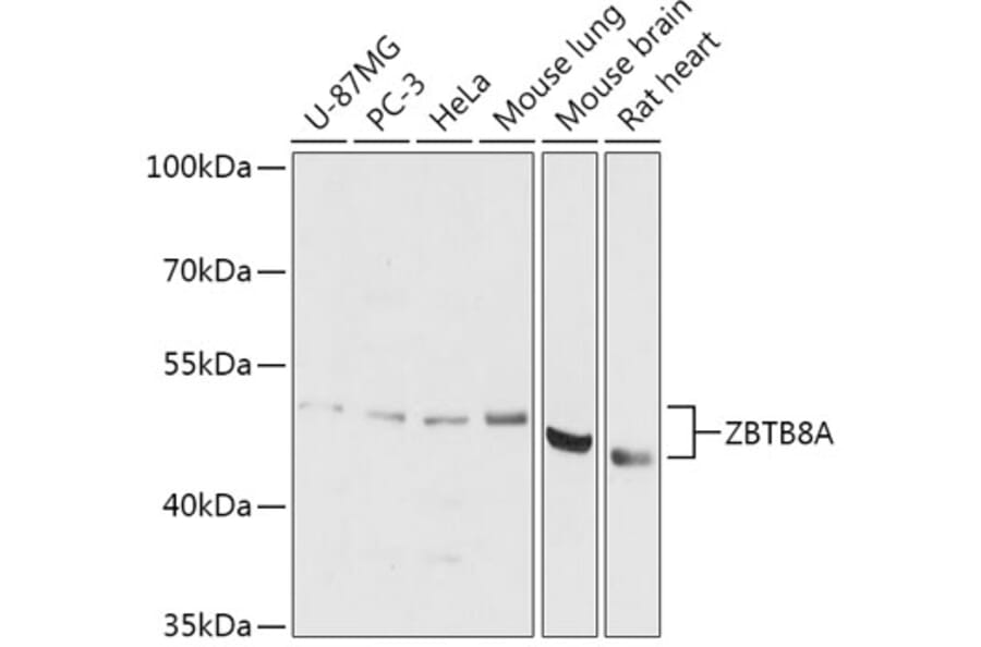 Western Blot - Anti-ZBTB8A Antibody (A306175) - Antibodies.com