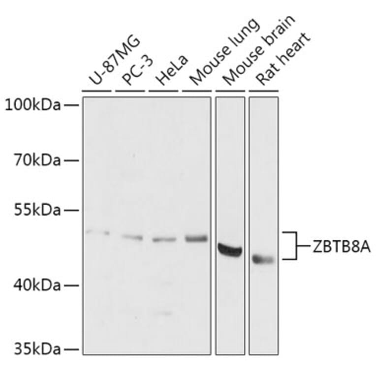 Western Blot - Anti-ZBTB8A Antibody (A306175) - Antibodies.com
