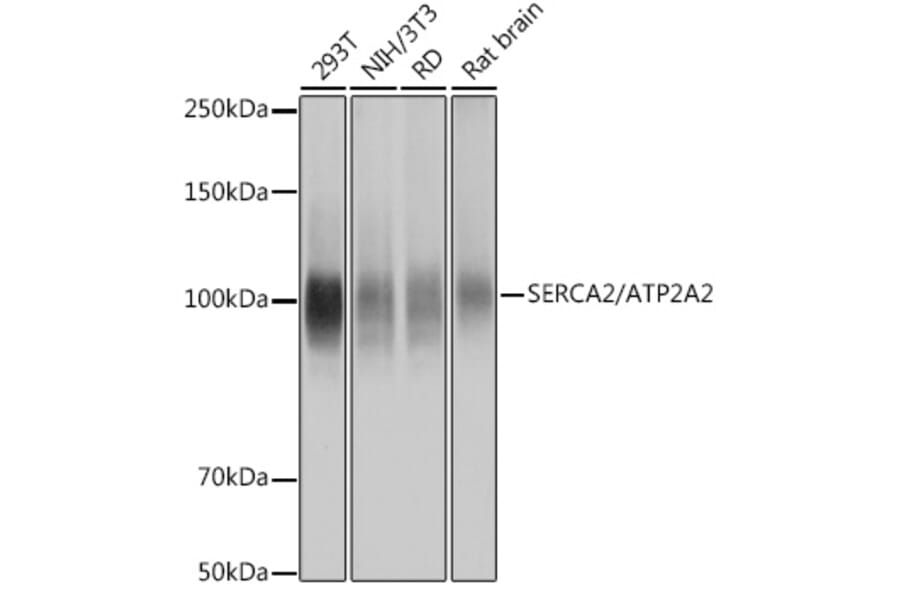 Western Blot - Anti-SERCA2 ATPase Antibody [ARC0679] (A306176) - Antibodies.com