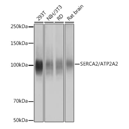 Western Blot - Anti-SERCA2 ATPase Antibody [ARC0679] (A306176) - Antibodies.com