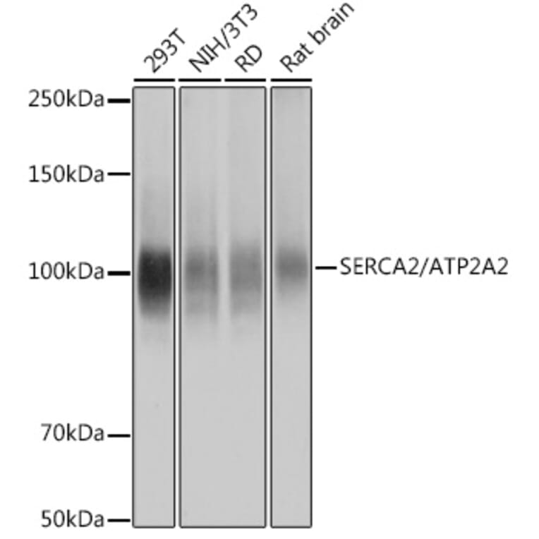 Western Blot - Anti-SERCA2 ATPase Antibody [ARC0679] (A306176) - Antibodies.com