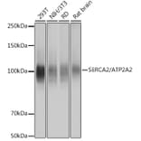 Western Blot - Anti-SERCA2 ATPase Antibody [ARC0679] (A306176) - Antibodies.com