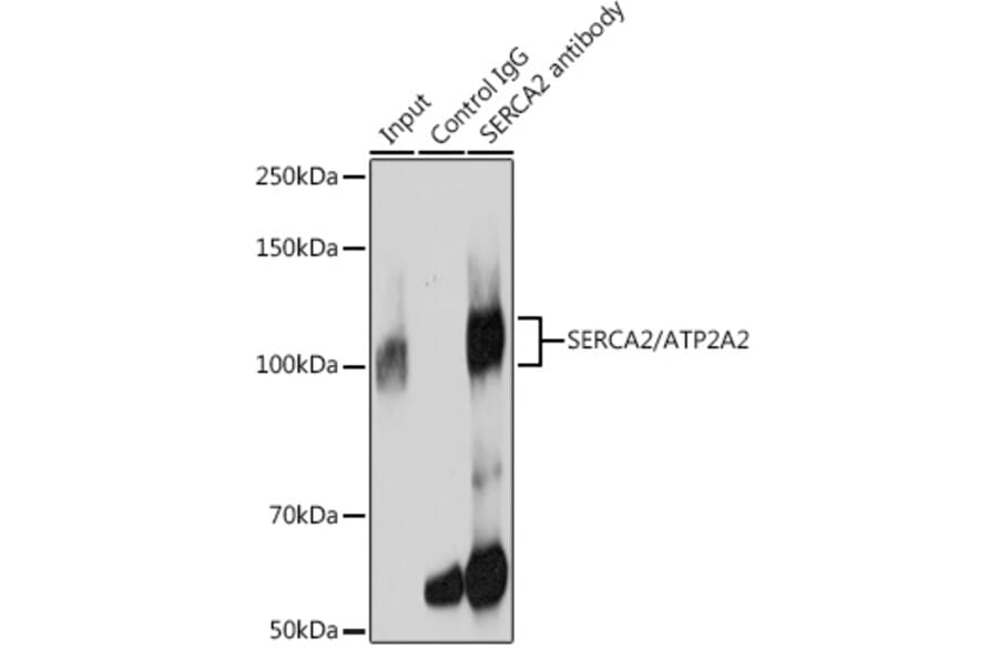 Western Blot - Anti-SERCA2 ATPase Antibody [ARC0679] (A306176) - Antibodies.com