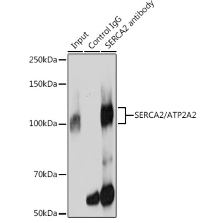 Western Blot - Anti-SERCA2 ATPase Antibody [ARC0679] (A306176) - Antibodies.com