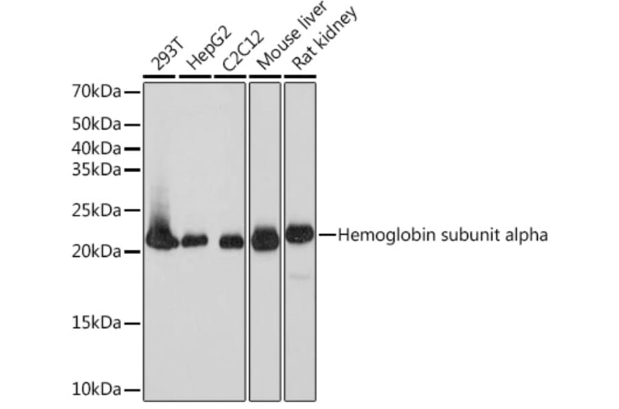 Western Blot - Anti-Dihydrofolate reductase (DHFR) Antibody [ARC1513] (A306177) - Antibodies.com
