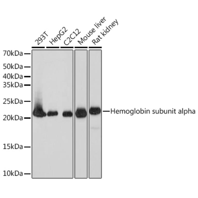 Western Blot - Anti-Dihydrofolate reductase (DHFR) Antibody [ARC1513] (A306177) - Antibodies.com