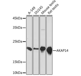 Western Blot - Anti-AKAP14 Antibody [ARC2344] (A306178) - Antibodies.com