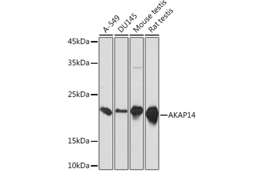Western Blot - Anti-AKAP14 Antibody [ARC2344] (A306178) - Antibodies.com