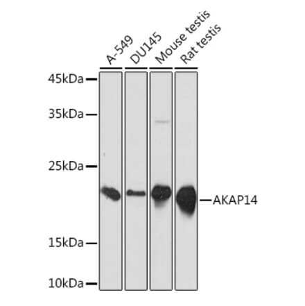 Western Blot - Anti-AKAP14 Antibody [ARC2344] (A306178) - Antibodies.com