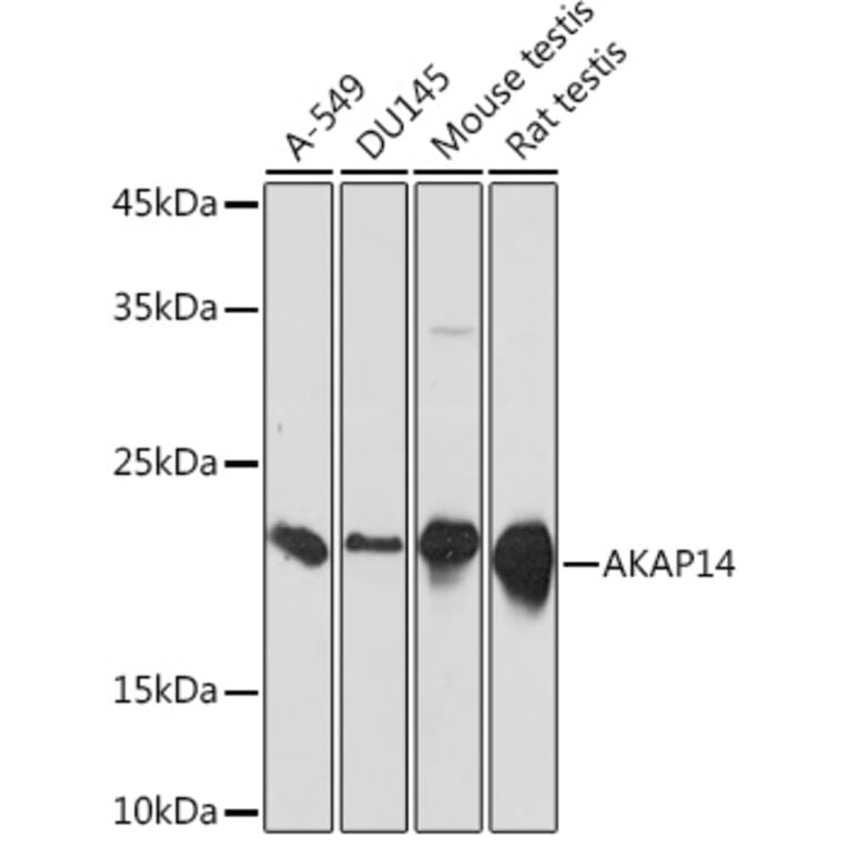 Western Blot - Anti-AKAP14 Antibody [ARC2344] (A306178) - Antibodies.com