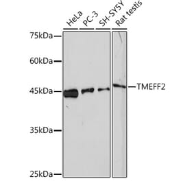 Western Blot - Anti-TMEFF2 Antibody [ARC2117] (A306179) - Antibodies.com