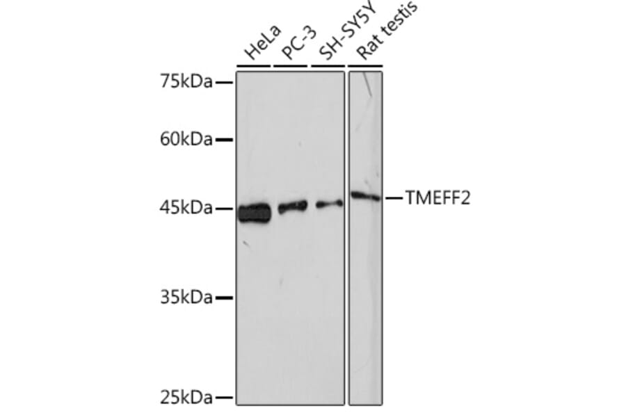 Western Blot - Anti-TMEFF2 Antibody [ARC2117] (A306179) - Antibodies.com