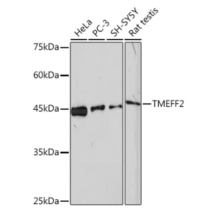 Western Blot - Anti-TMEFF2 Antibody [ARC2117] (A306179) - Antibodies.com