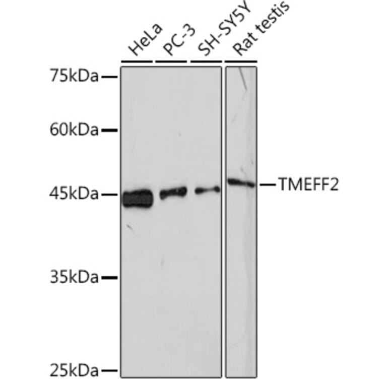 Western Blot - Anti-TMEFF2 Antibody [ARC2117] (A306179) - Antibodies.com