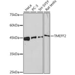 Western Blot - Anti-TMEFF2 Antibody [ARC2117] (A306179) - Antibodies.com