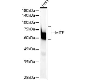 Western Blot - Anti-MiTF Antibody [ARC55801] (A306180) - Antibodies.com