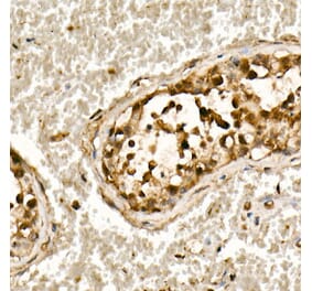 Western Blot - Anti-Smad3 Antibody [ARC53861] (A306181) - Antibodies.com