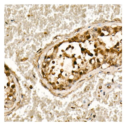 Western Blot - Anti-Smad3 Antibody [ARC53861] (A306181) - Antibodies.com