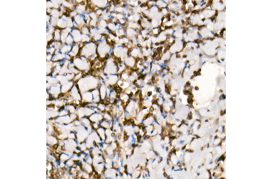 Western Blot - Anti-Smad3 Antibody [ARC53861] (A306181) - Antibodies.com