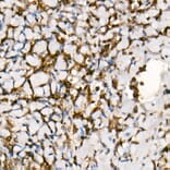 Western Blot - Anti-Smad3 Antibody [ARC53861] (A306181) - Antibodies.com