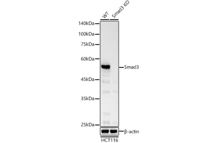 Immunohistochemistry - Anti-Smad3 Antibody (A306181) - Antibodies.com