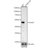 Immunohistochemistry - Anti-Smad3 Antibody (A306181) - Antibodies.com