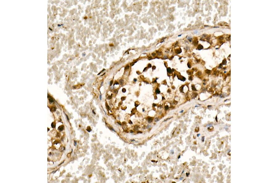Immunohistochemistry - Anti-Smad3 Antibody (A306181) - Antibodies.com
