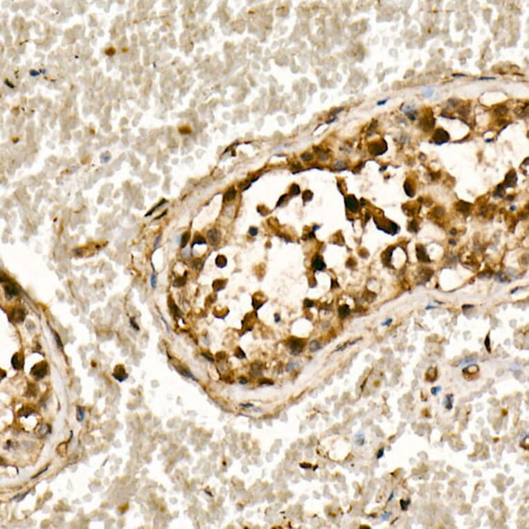 Immunohistochemistry - Anti-Smad3 Antibody (A306181) - Antibodies.com