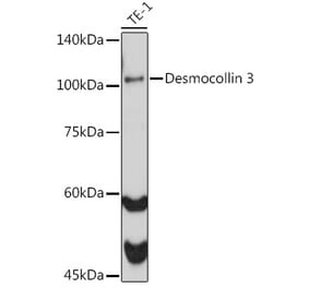 Western Blot - Anti-Desmocollin 3 Antibody [ARC2506] (A306184) - Antibodies.com