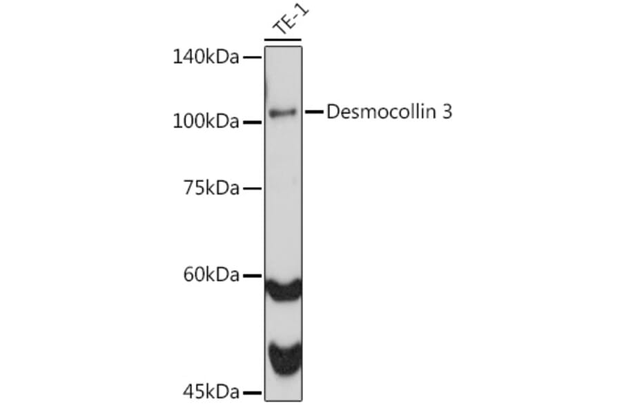 Western Blot - Anti-Desmocollin 3 Antibody [ARC2506] (A306184) - Antibodies.com