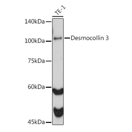 Western Blot - Anti-Desmocollin 3 Antibody [ARC2506] (A306184) - Antibodies.com