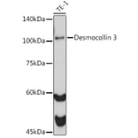 Western Blot - Anti-Desmocollin 3 Antibody [ARC2506] (A306184) - Antibodies.com