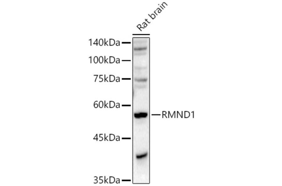 Western Blot - Anti-RMND1 Antibody (A306185) - Antibodies.com