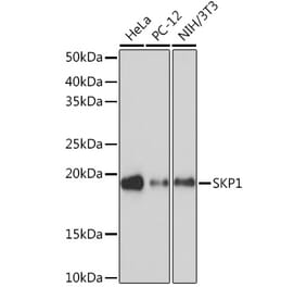 Western Blot - Anti-Skp1 Antibody [ARC1384] (A306186) - Antibodies.com