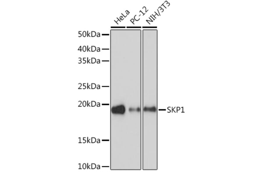 Western Blot - Anti-Skp1 Antibody [ARC1384] (A306186) - Antibodies.com