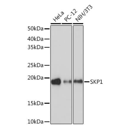 Western Blot - Anti-Skp1 Antibody [ARC1384] (A306186) - Antibodies.com